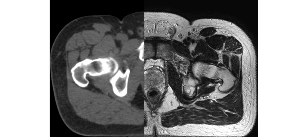 Experience the MRI difference