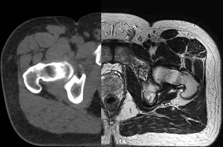 Experience the MRI difference