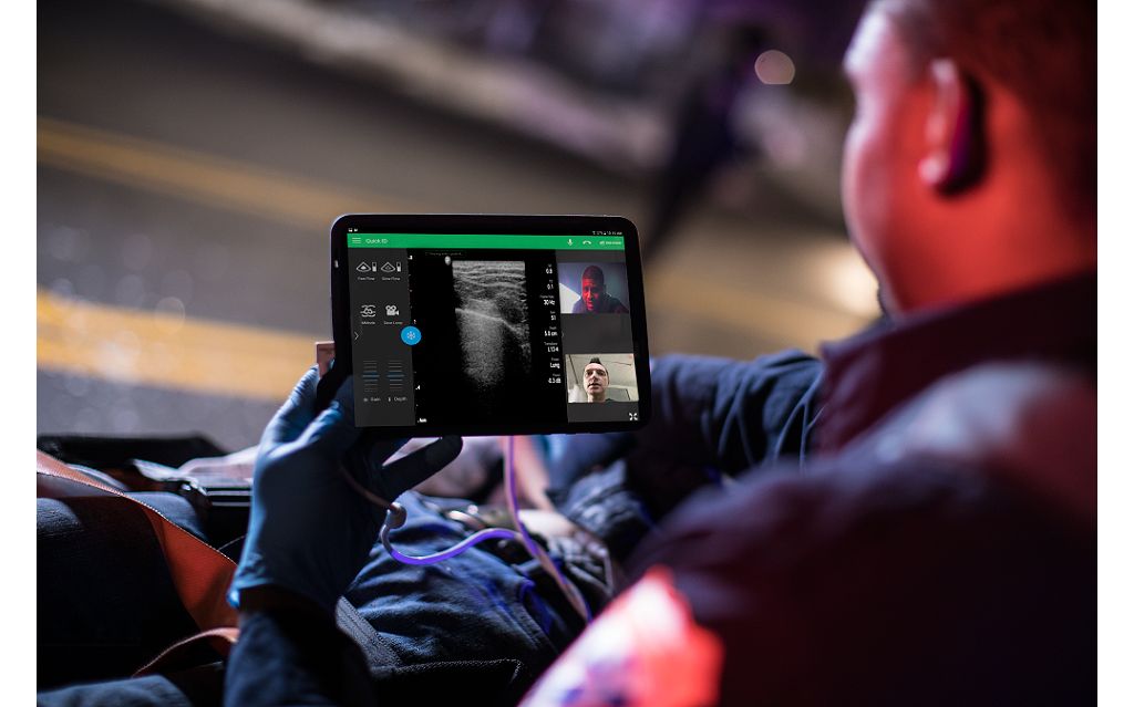 Integrated tele-ultrasound: