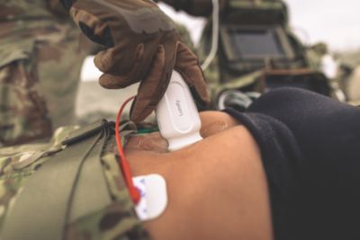 The Philips Lumify mobile ultrasound device