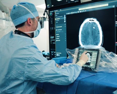 Leading experts in field of stroke about Improving stroke care