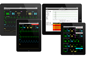 IntelliVue Aplicación móvil para datos de monitoreo del paciente