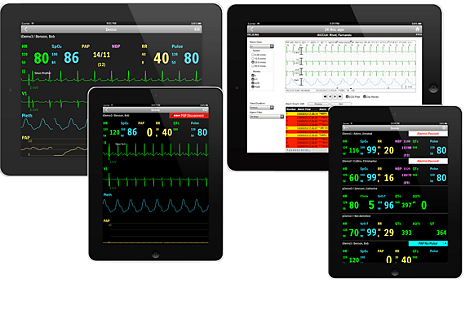 IntelliVue Mobile app for patient monitoring data