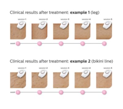 Enostavno in učinkovito