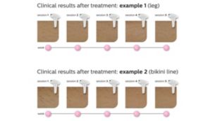Resultados garantizados sin esfuerzo