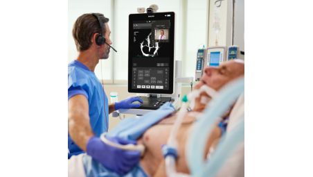 Collaboration Live tele-ultrasound