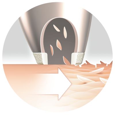 The exfoliating tip stimulates the cell renewal process