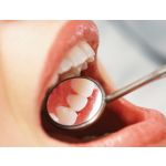 Whiter, healthier teeth