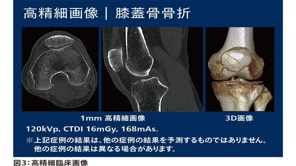 図3：高精細臨床画像