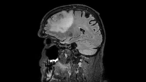3D BrainVIEW FLAIR