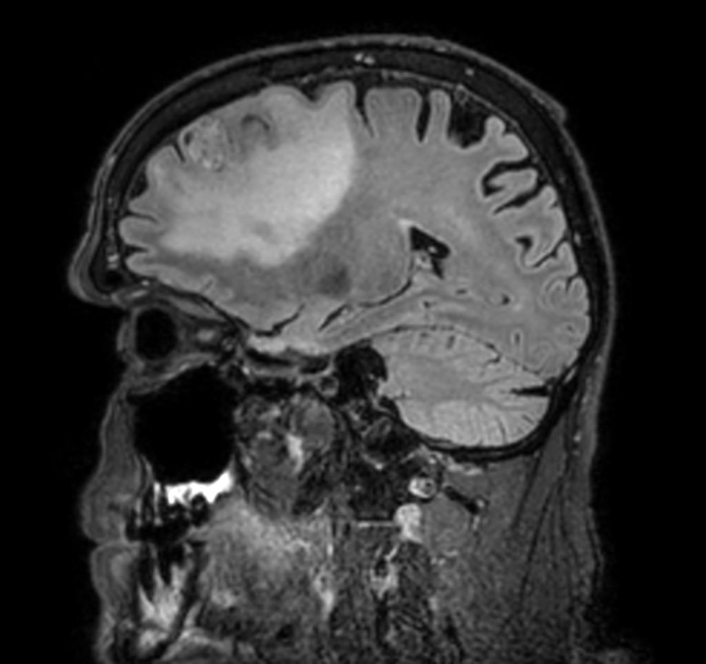 3D BrainVIEW FLAIR
