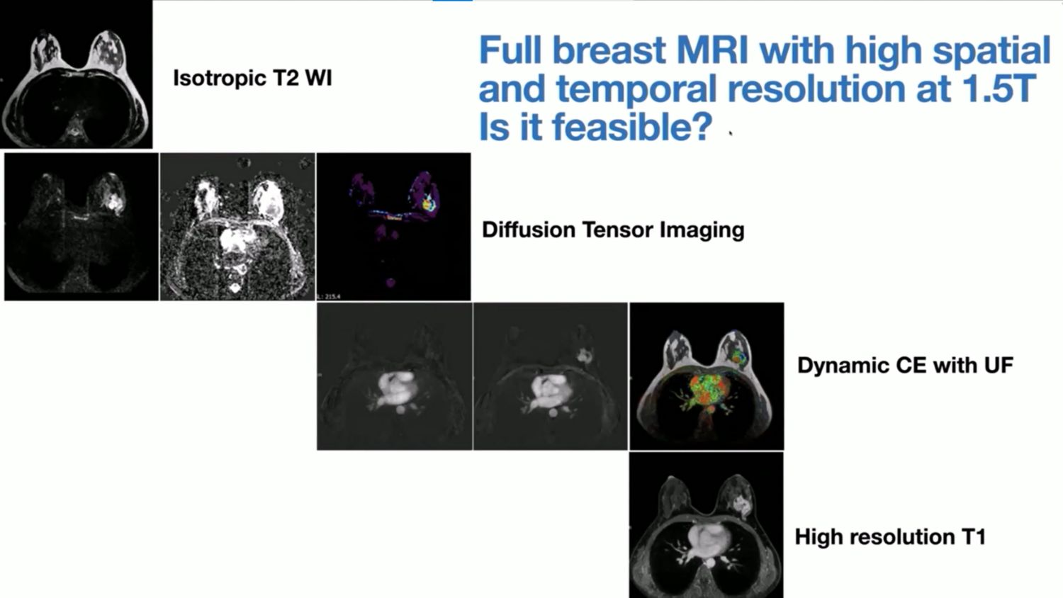 Breast MRI Imaging webinar with Dr. Julia Camps Herrero