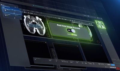Interfaz de software de RM con vista previa predictiva de imágenes mediante IA antes de la exploración