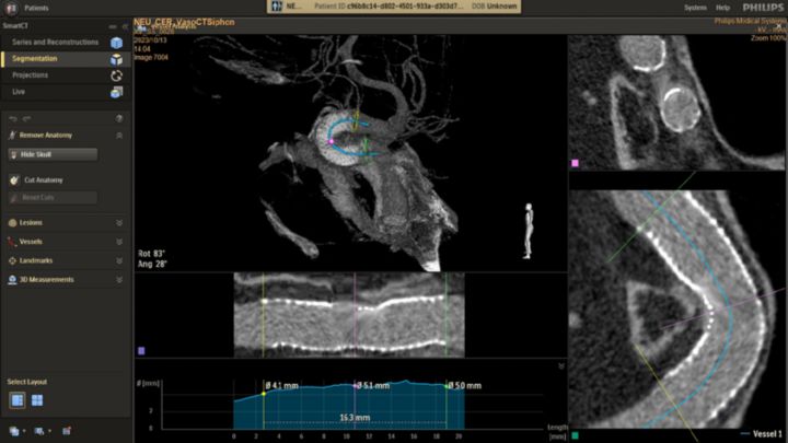 Smart CT