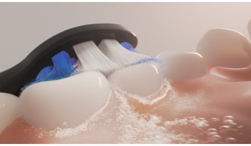 Tecnologia Sonicare comprovata