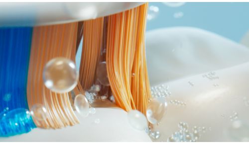 Pulizia sonica: il capolavoro di una pulizia efficace