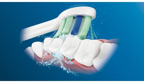 Sonic technology that pulses between teeth