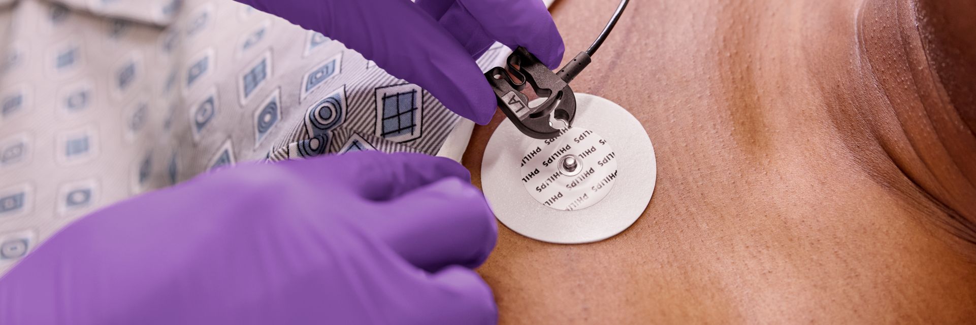 electrodes and ecg leads