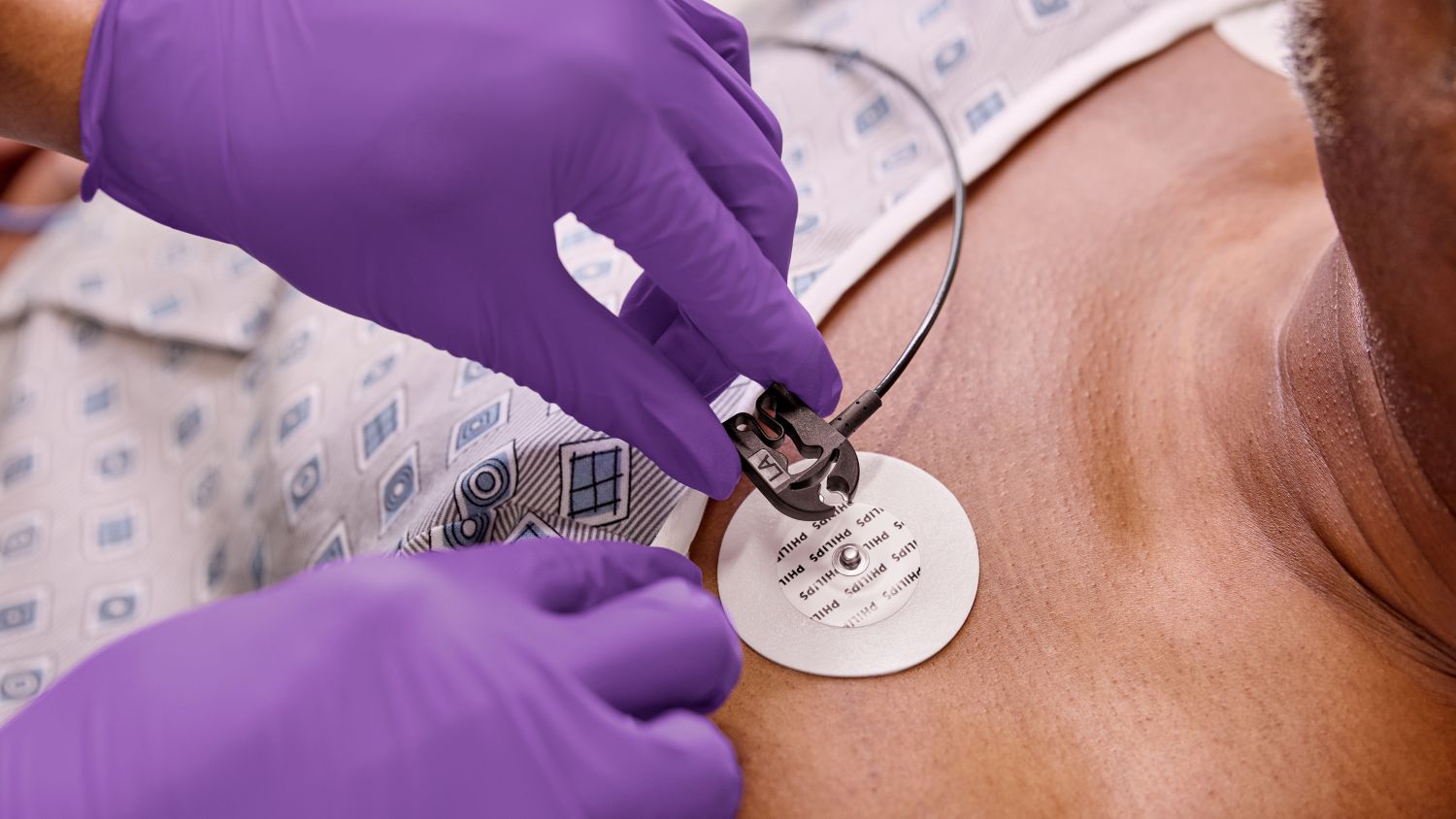 ECG lead placement on male patient