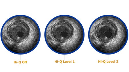 3 Hi-Q imaging options