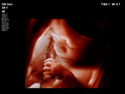 Ultrasound web TrueVue