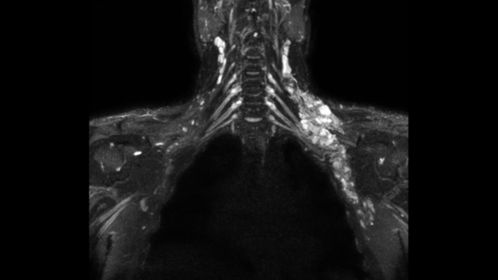 

3D NerveVIEW

