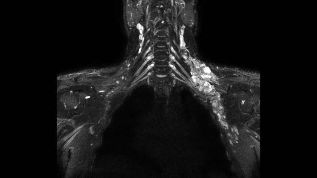 

3D NerveVIEW

