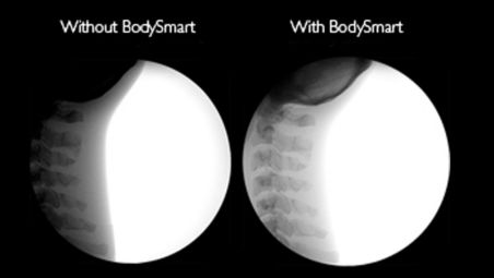 Save time and X-ray dose with BodySmart software