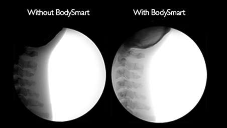 Save time and X-ray dose with BodySmart software