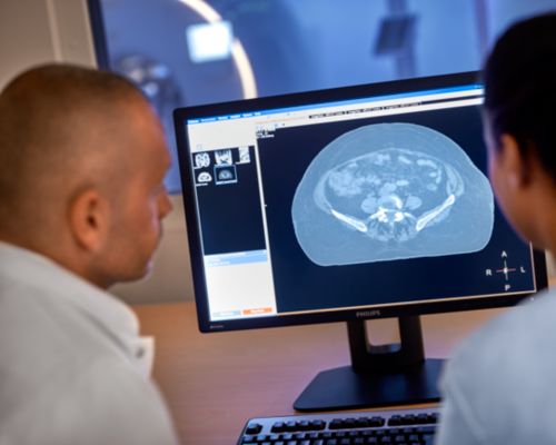 MR-gebaseerde radiotherapieplanning