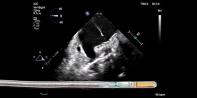 VeriSight Single Plane Steerable 2D ICE Catheter 