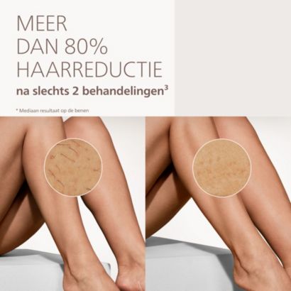 Dag haartjes, hallo gladde huid