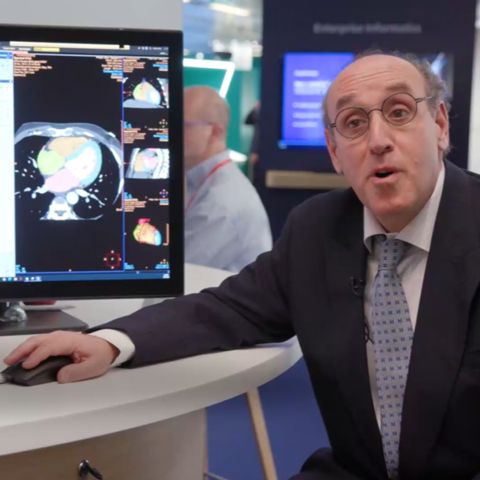 Vidéo des avantages de l’AVW, de l’intégration PACS et des processus de travail basés sur l’IA pour l’analyse cardiaque