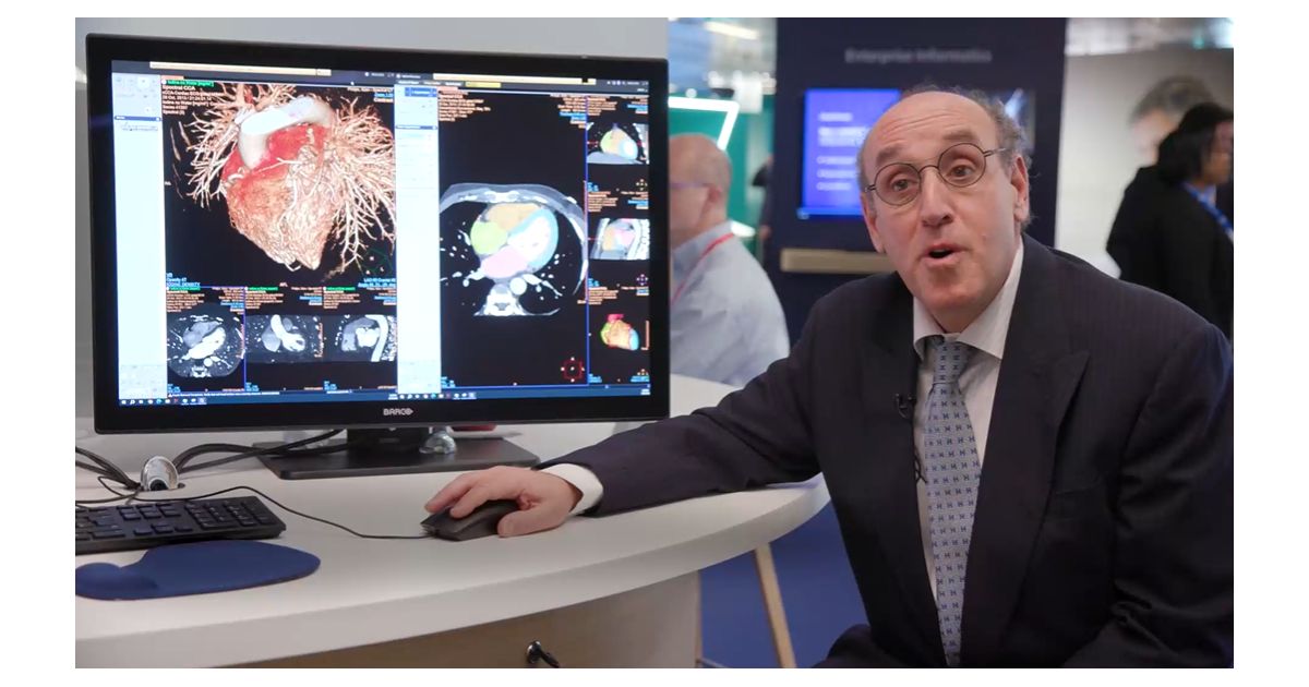 Advanced Visualization - Philips