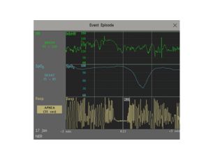 Neonatal Event Review Clinical decision support tool