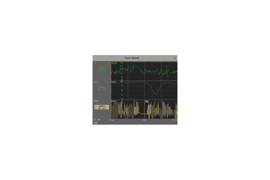 Standard product photograph