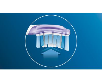 Focus on gum health