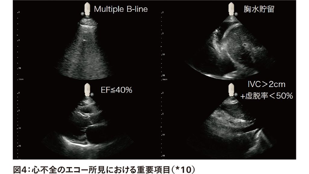 図4：心不全のエコー所見における重要項目（*10）

