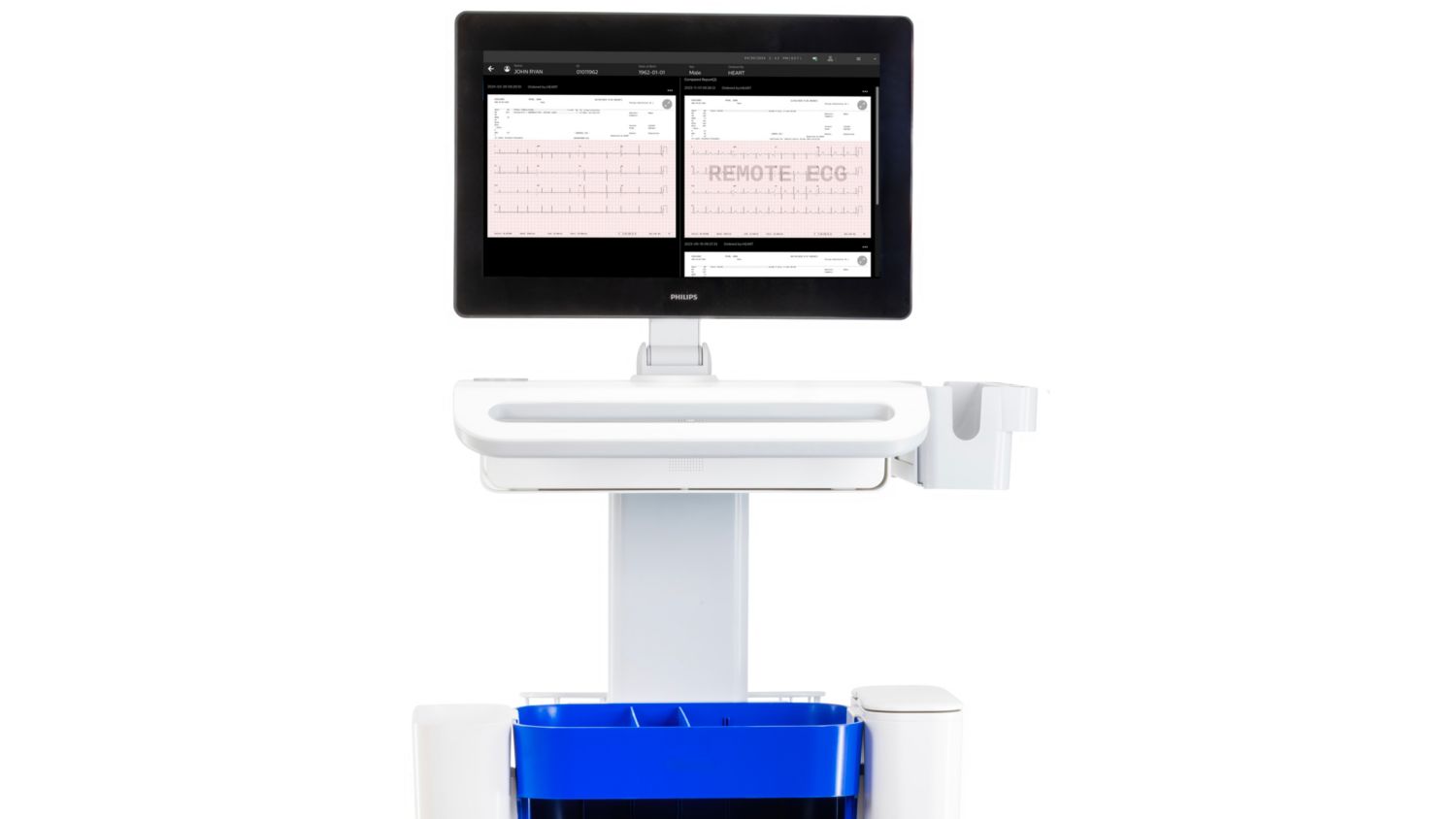 Image of the Cardiac Workstation screen comparing current and previous ECGs side by side.