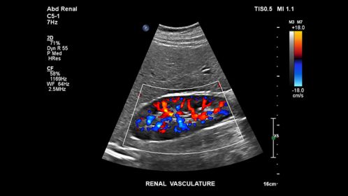 Renal vasculature