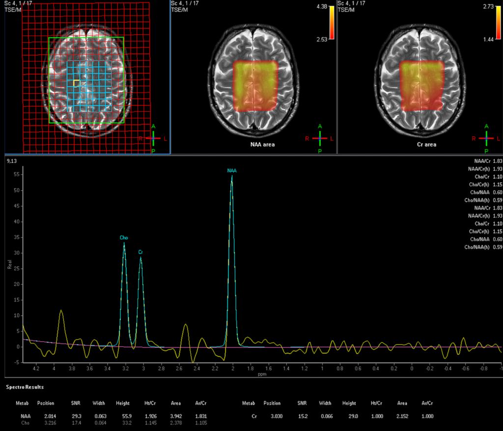 Spectroscopy Imaging
