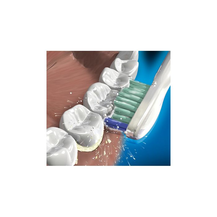 FlexCare Sonic electric toothbrush HX6942/04 | Sonicare