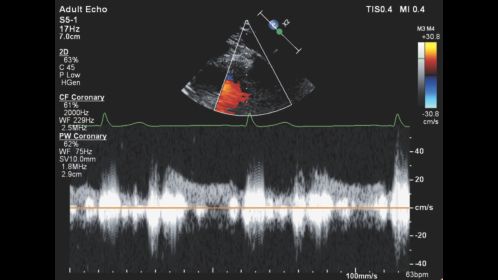 Affiniti CVx Doppler