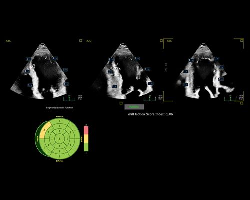 Philips CV Ultrasound platform - Philips Healthcare