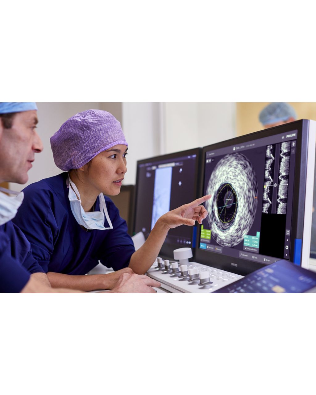 Coronary IVUS