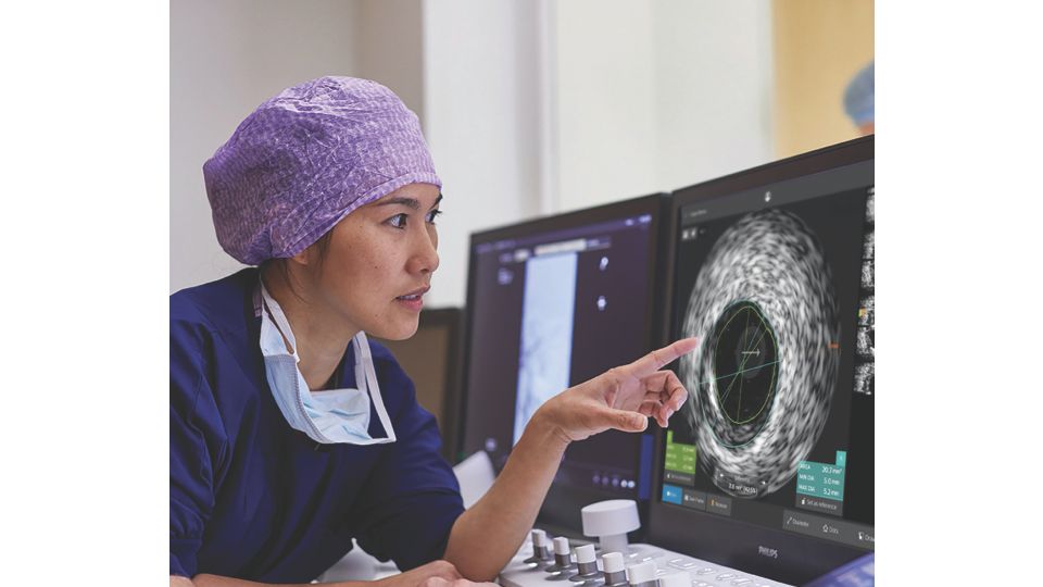Coronary IVUS study