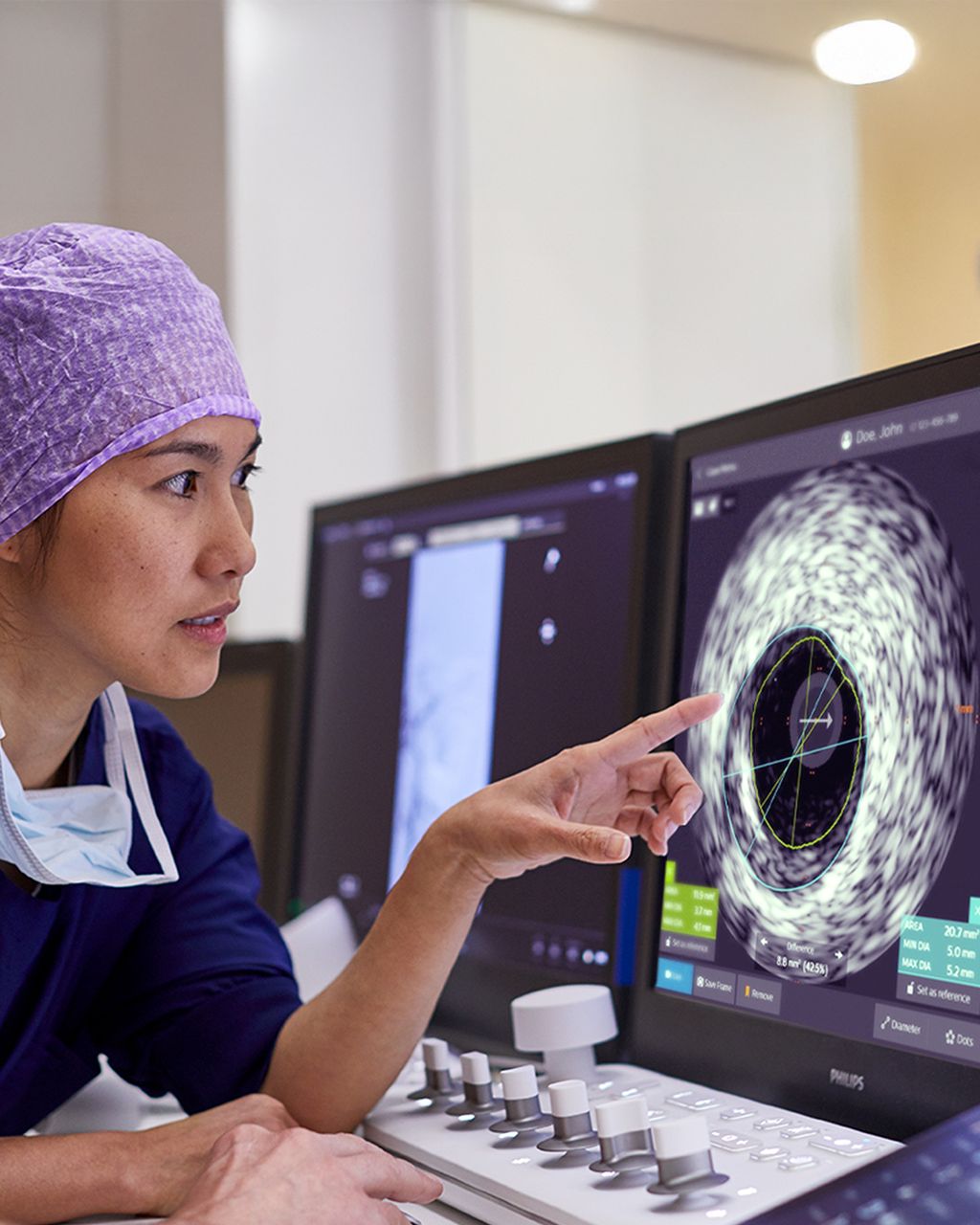 Coronary IVUS