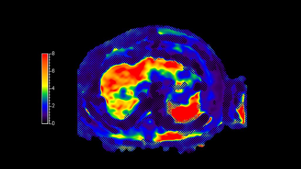 MR Elastography Extension 2D SE-EPI