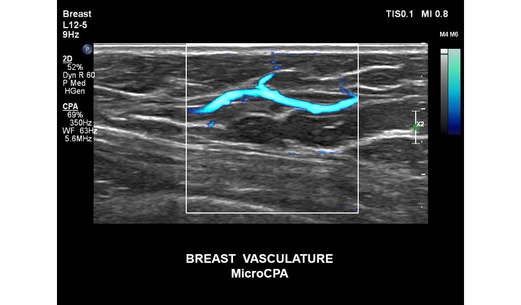 Breast vasculature