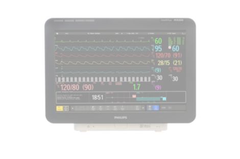 IntelliVue Bedside patient monitor